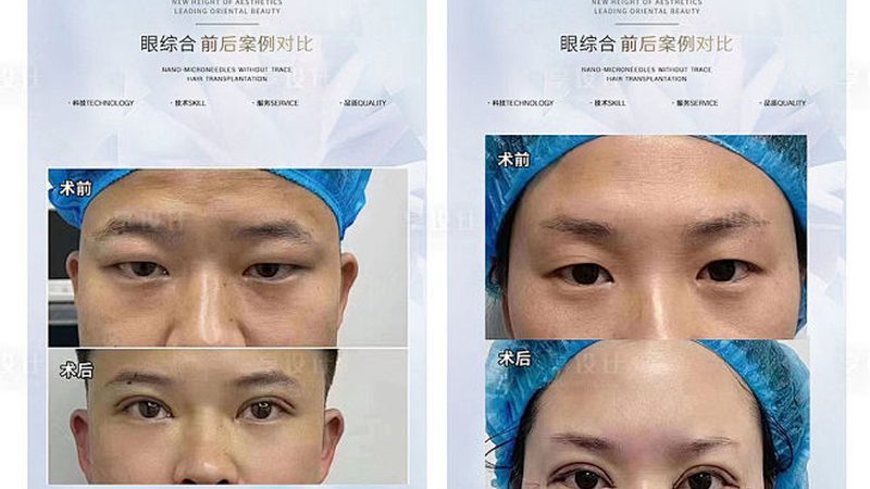 行业现状：美容整形市场蓬勃发展，消费者需求多样化