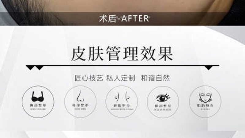 北京瘦脸手术，医保报销之谜