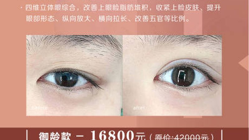 皮肤管理公司新手入门：如何规避误区，选择优质服务