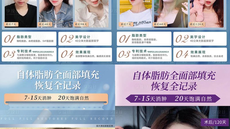 光子嫩肤术后，这些细节不能忽视**