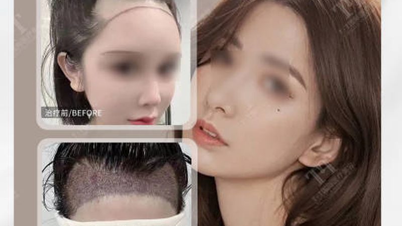 皮肤管理中心产品加盟，先看清这五道门槛
