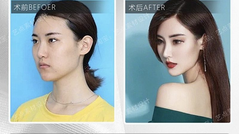 揭秘注射美容设备：参数表背后的技术奥秘
