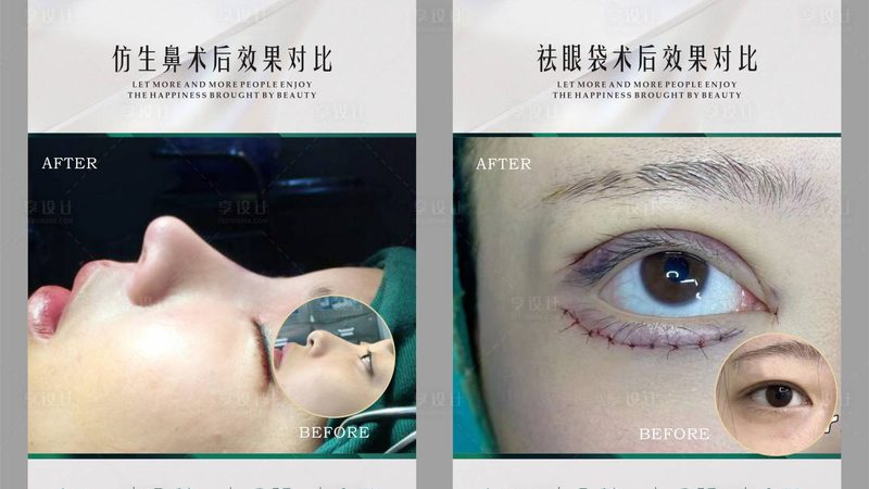 水光针注射，揭秘其专业操作流程