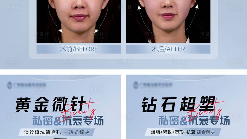 热玛吉加盟代理，揭秘行业“黑科技”的加盟之路