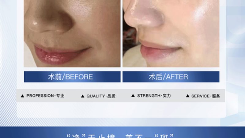 轻医美和医疗美容哪个更安全