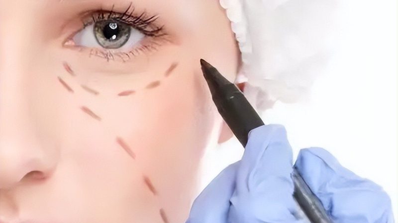 武汉大腿吸脂价格差异背后藏着什么