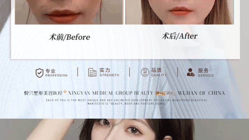 小标题：手术原理与效果