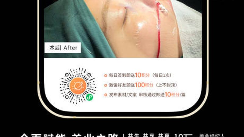 激光祛雀斑，为什么同一台机器效果天差地别