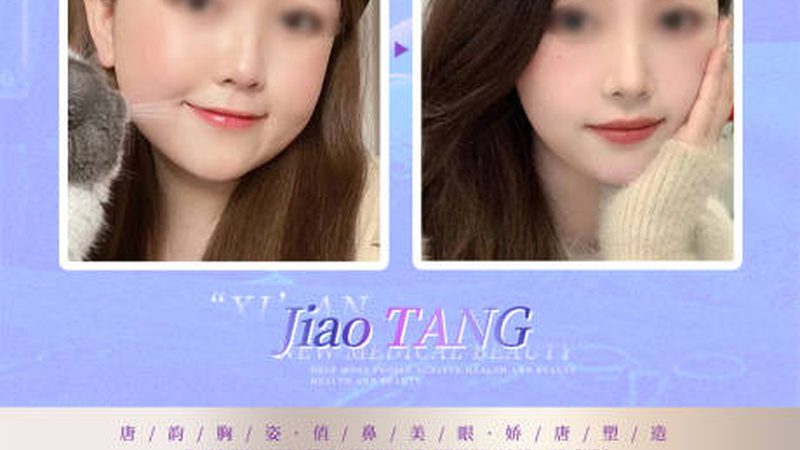 光子嫩肤和激光哪个适合敏感肌