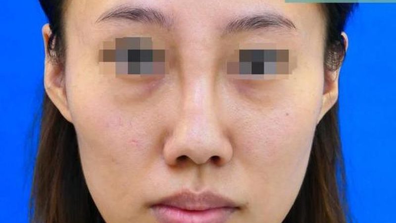 皮肤管理加盟，费用包含哪些关键项目？**